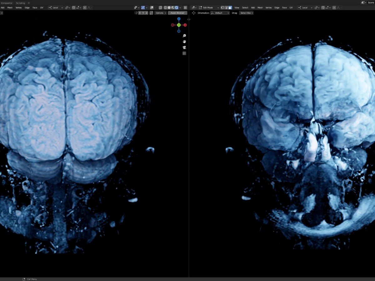 MRI Visualizations in&nbsp;Blender