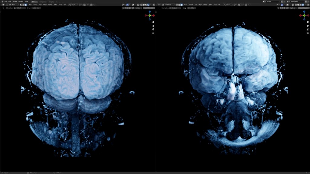 MRI Visualizations in&nbsp;Blender