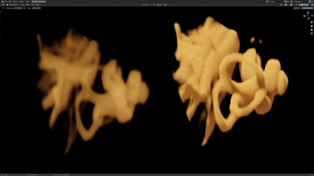 Modified Deep Head Hanging Manoeuvre for Complex BPPV&nbsp;Presentations