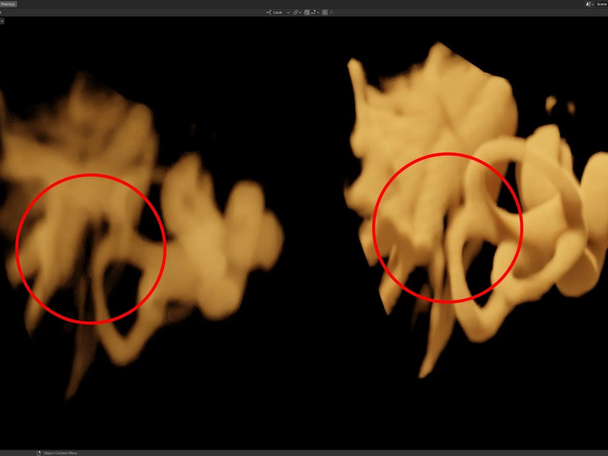 Are Vestibular Disorders Frequently&nbsp;Misdiagnosed?